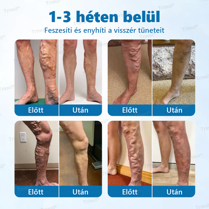 đ GratulĂĄlunk! Ma Ăn a szerencsĂ©s vĂĄsĂĄrlĂłk egyike. đ KĂŒlönleges ajĂĄndĂ©kkĂ©nt extra 50%-os kedvezmĂ©nyt kapott! Kezdje el ma a TrimilÂź hasznĂĄlatĂĄt, Ă©s lĂ©pjen a tovĂĄbb egĂ©szsĂ©gesebb, szebb Ă©let felĂ©!