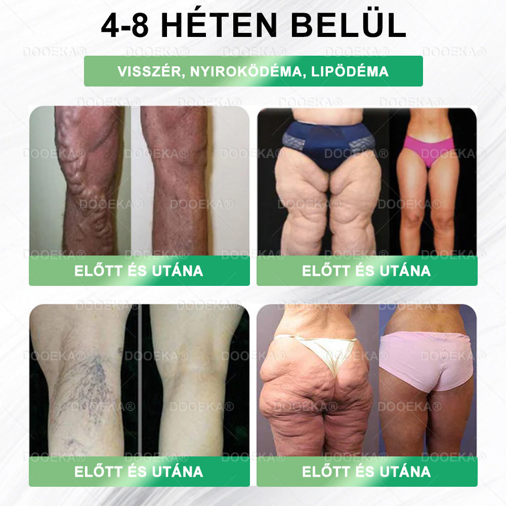 🎁 Már csak 5 doboz maradt! Most extra 50% kedvezményt kapsz! Tartsd formában magad – ha most kihagyod, jövőre már nem lesz ilyen lehetőséged! 💖