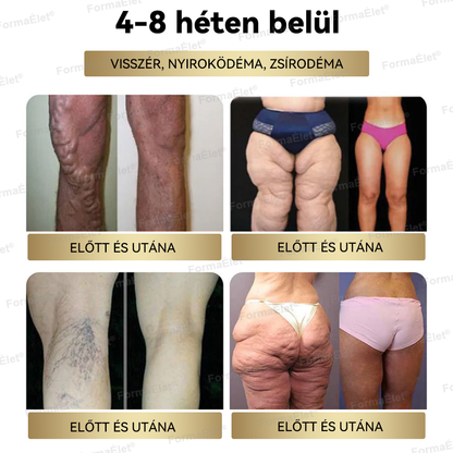 ✨Hivatalos üzlet | FormaÉlet® GLP-1 Moringa Fogyókúrás és Egészségfokozó cseppek 🔥 (Élelmiszer-minőségű zsírégető – Az Obesity Society fejlesztése)