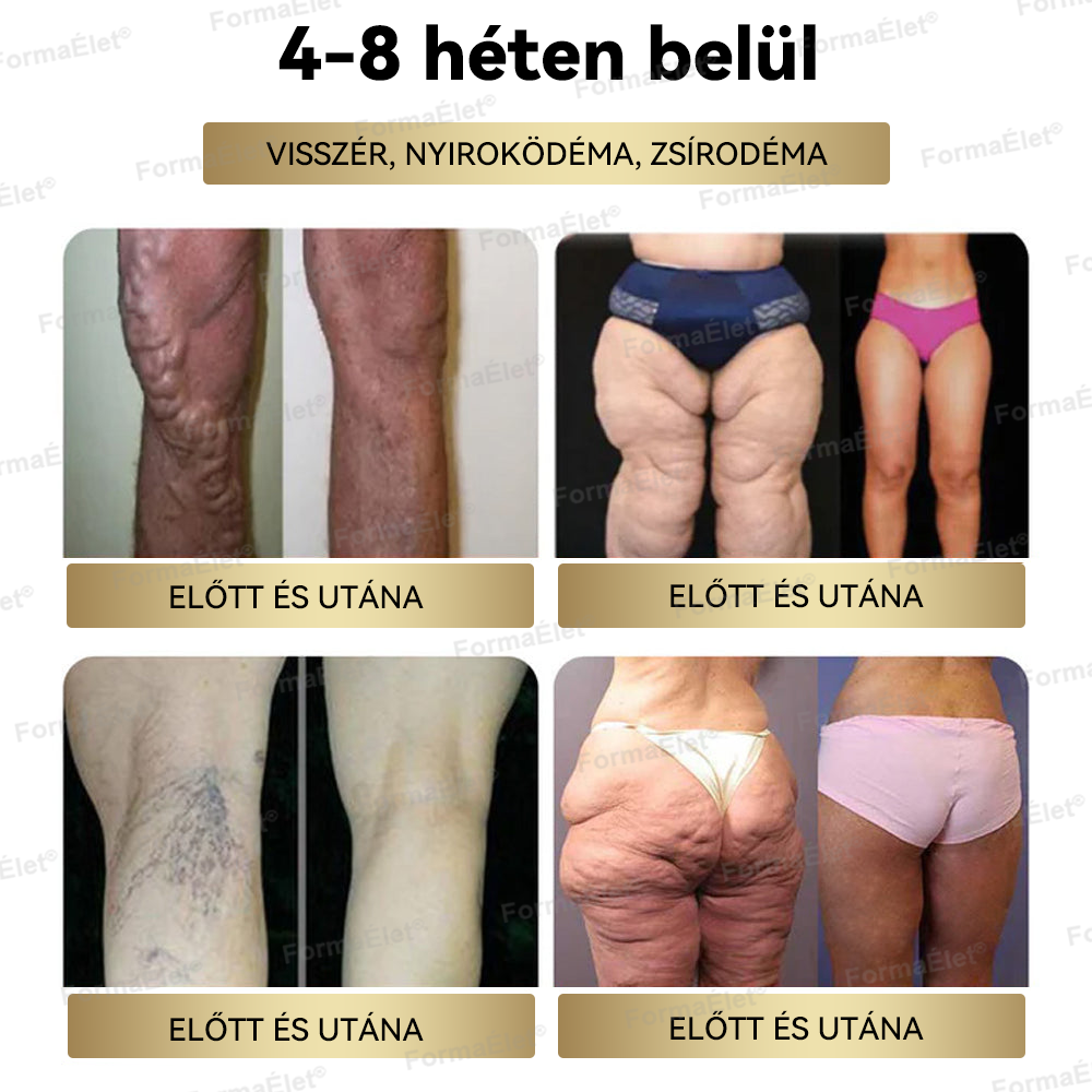 🎈Hivatalos üzlet | FormaÉlet® GLP-1 Moringa Fogyókúrás és Egészségfokozó cseppek 🔥 (Élelmiszer-minőségű zsírégető – Az Obesity Society fejlesztése)