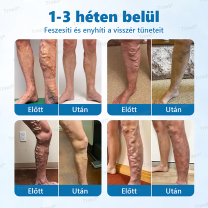 🎉 Gratulálunk! Ma Ön a szerencsés vásárlók egyike. 🎁 Különleges ajándékként extra 50%-os kedvezményt kapott! Kezdje el ma a Trimil® használatát, és lépjen a tovább egészségesebb, szebb élet felé!