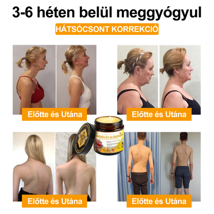📢Gbpurity Méhméreg és Glükózamin Ízületi Krém – Hivatalos Márkabolt, MOT Jóváhagyással