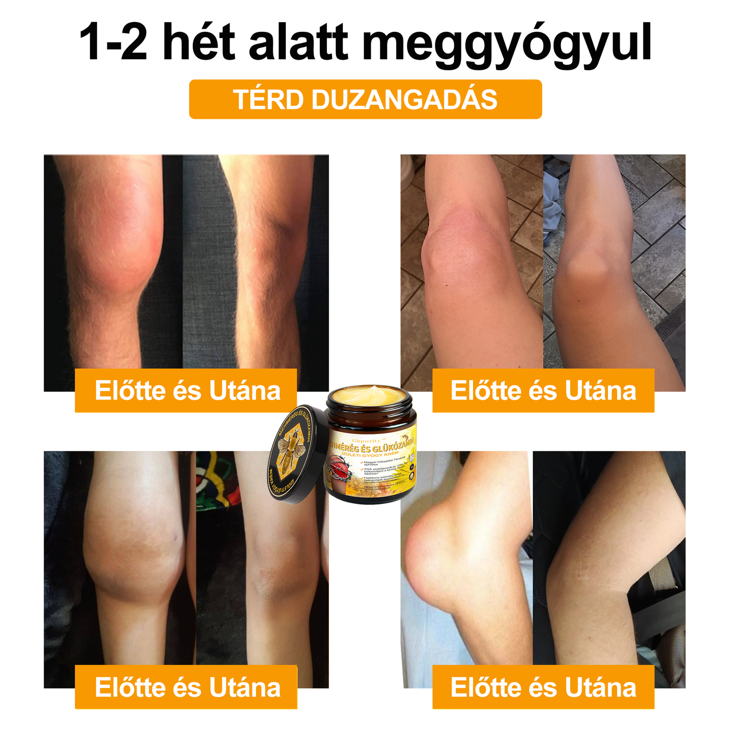 📢Gbpurity Méhméreg és Glükózamin Ízületi Krém – Hivatalos Márkabolt, MOT Jóváhagyással