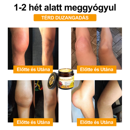 📢Gbpurity Méhméreg és Glükózamin Ízületi Krém – Hivatalos Márkabolt, MOT Jóváhagyással