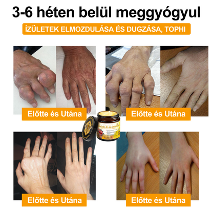📢Gbpurity Méhméreg és Glükózamin Ízületi Krém – Hivatalos Márkabolt, MOT Jóváhagyással