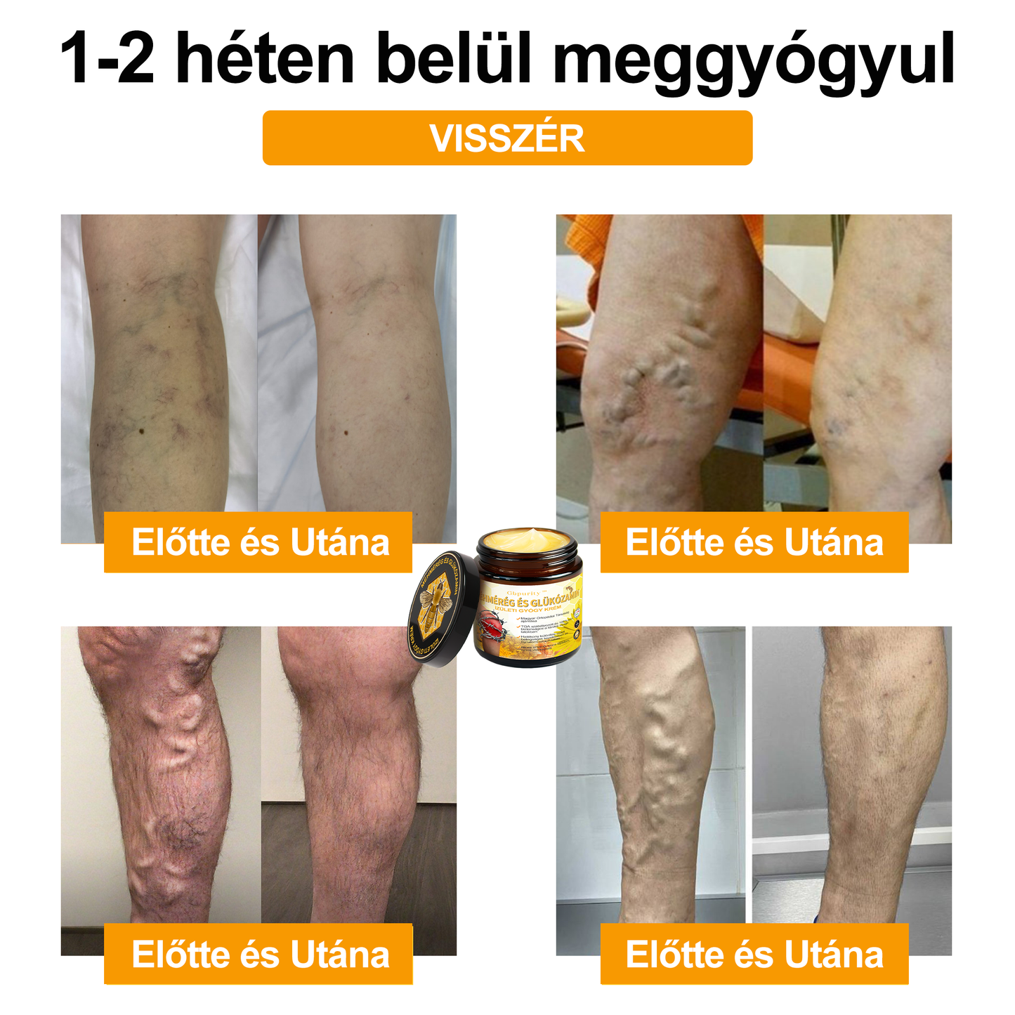 📢Gbpurity Méhméreg és Glükózamin Ízületi Krém – Hivatalos Márkabolt, MOT Jóváhagyással