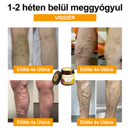 📢Gbpurity Méhméreg és Glükózamin Ízületi Krém – Hivatalos Márkabolt, MOT Jóváhagyással